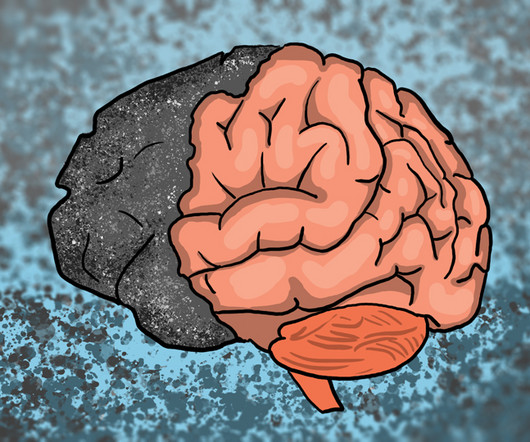 article thumbnail